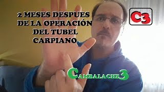 OPERACION TUNEL CARPIANO 2 MESES DESPUES 4ª PARTE [upl. by Kalin]