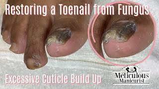 👣How To Pedicure a Toenail Fungus  Restoration Process👣 [upl. by Mcclain388]