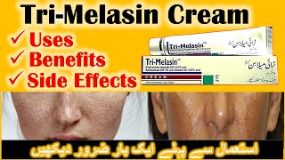 Trimelasin cream reviewTrimelasin Benefits amp side effectshow to use trimelasin creamanti melasma [upl. by Kassaraba]