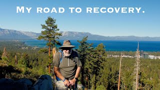 Esophageal Cancer Eds Story from Treatment to Recovery [upl. by Ru]