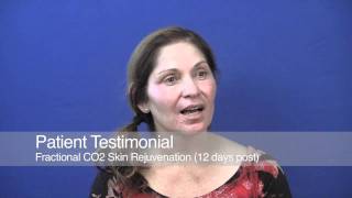 Patient Testimonial  Fractional CO2 Laser Skin Rejuvenation [upl. by Joelynn]