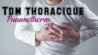 TDM THORACIQUE  Pneumothorax de petite à moyenne abondance [upl. by Leuams]