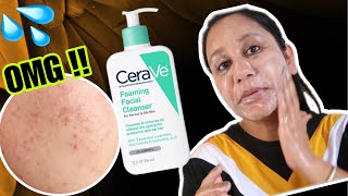 Cerave Foaming Cleanser For Oily Acne Prone Skin [upl. by Ljoka]