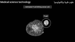 الخلايا التائية في مواجهة السرطان تحت المجهر Tcellsvscancerunderthemicroscope [upl. by Shoshanna]