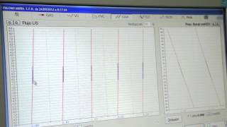 Volúmenes Pulmonares por Pletismografía corporal Prueba [upl. by Okikuy96]