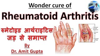 Rheumatoid arthritis cured case Permanent cure of Rheumatoid arthritis [upl. by Viviene]