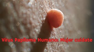 VIRUS PAPILOMA HUMANO CUÍDATE MUJER [upl. by Leyla]