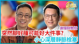 突然腳好腫可能好大件事 小心深層靜脈栓塞 [upl. by Goodkin587]