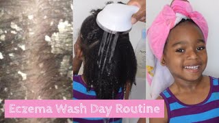 Eczema Wash Day Routine For Kids No More Itchy Scalp Seborrheic DERMATITIS [upl. by Niggem825]