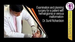 Examination and planning surgery for a patient with hemangioma or venous malformation Dr Richardson [upl. by Obara]