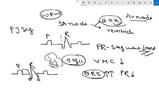 ACCELERATED AV CONDUCTION LOWN GANONG SYNDROME  WOLFF PARKINSON SYNDROME [upl. by Vonnie]