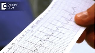 What are the types of arrhythmia  Dr Mohammed Haroon [upl. by Maillij]