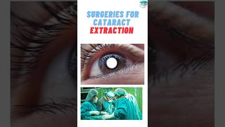 Various surgical procedures for Cataract extractioncataract cataractsurgery cataractsurgeon [upl. by Dehsar]