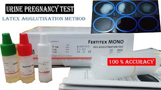 Urine Test for Pregnancy in Hospital ।। Urine Test Bangla।। Urine HCG by Latex Agglutination Method [upl. by Lai874]