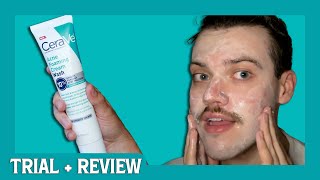 cerave acne foaming cream wash BPO 10  trial  review [upl. by Ahsaele]