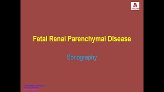 Fetal Renal Parenchymal Disease [upl. by Akitan]