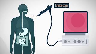 MiGUT  An ingestible device for gastric electrophysiology [upl. by Llevra]