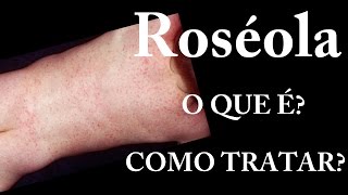 Roséola  O que é  Sintomas  Tratamento [upl. by Aicillyhp]