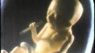 American Cancer Society  Smoking Fetus 1985 USA [upl. by Gluck]