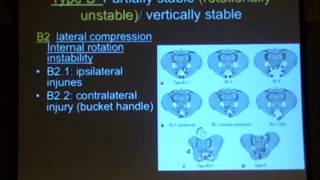 3 Classification of pelvic ring disruption Acharyria [upl. by Margreta]