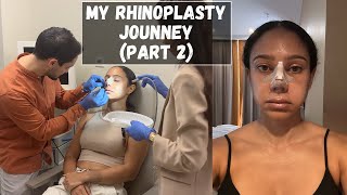 My RHINOPLASTY JOURNEY amp SEMI REVEAL Part 2  Tiana Peri [upl. by Ynaoj]