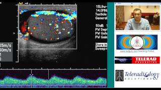 Ultrasound of Acute Epididymo Orchitis by Dr Arjun Kalyanpur [upl. by Eener]