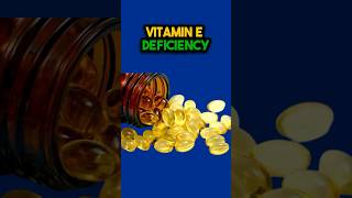 Most POWERFUL Vitamin E Benefits To REPAIR amp Heal vitamine nutritiontips [upl. by Dwaine951]