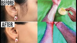 അനാവശ്യ രോമം കളയാം പോയ രോമം തിരികെ വരില്ല How to Remove Facial Hair permanently at home [upl. by Marybella]