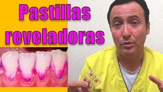 Pastillas reveladoras de placa dentobacteriana ¿Qué son y para qué sirven [upl. by Adiv982]