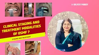 Clinical staging and treatment modalities of OSMF [upl. by Redienhcs79]