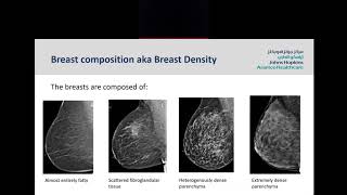 Screening Mammogram Understanding your Mammogram Report [upl. by Sheelagh]