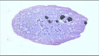 Cytology  Reactive lymph node [upl. by Dasie]