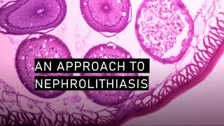 An approach to nephrolithiasis [upl. by Akenot]