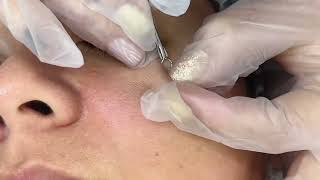 Limpieza facial profunda paso a paso [upl. by Caye414]