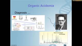 Organic Acidemia Overview and clinical presentation Dr Maha Alotaibi [upl. by Nertie]