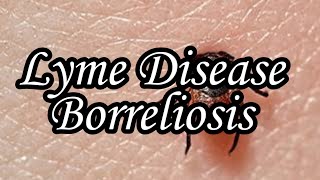 Lyme Disease  Borreliosis  Sign amp Symptoms Epidemio Stages Dx Tx Microbiology  MIsMedicine [upl. by Karylin]