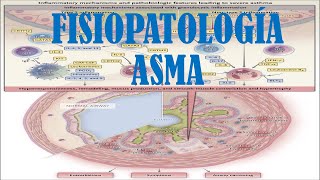 ASMA ETIOLOGÍA FISIOPATOLOGÍA Y DIAGNÓSTICO [upl. by Yramesor]