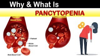 Why amp What Is Pancytopenia [upl. by Hubert]