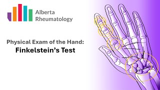 Rheumatology HAND exam Finkelsteins Test for DeQuervains Tenosynovitis [upl. by Keelia910]