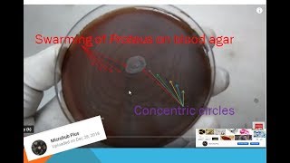 Swarming of proteus on blood agar  swarming inhibition by various methods Swarming [upl. by Marleah]