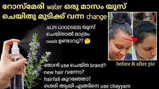 Rosemary water use ചെയ്ത് ഞെട്ടിക്കുന്ന റിസൾട്ട്‌😱 hair smoothening പണി തന്നു 😭with proof [upl. by Jasmina554]