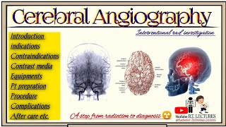 Cerebral Angiography Carotid Angiography Brain Angiography Interventional radiology BRT amp DRT [upl. by Ebner]