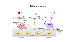 Low Bone Density Osteoporosis Code 178 [upl. by Vivian]