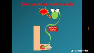 Dracunculus medinensis Dracontiasis الدودة التنين [upl. by Nashner593]