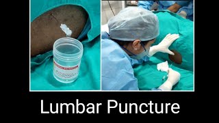 How to do Lumbar Puncture  How to do CSF study [upl. by Aynekat]