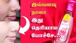 Benefits Of Rose Water For Skin  Tamil Beauty Tv [upl. by Oel463]