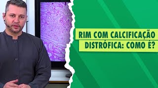 Patologia Veterinária Calcificação Distrófica [upl. by Yelekalb]