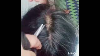 Plucking White Hair  Very Relaxing [upl. by Haik683]