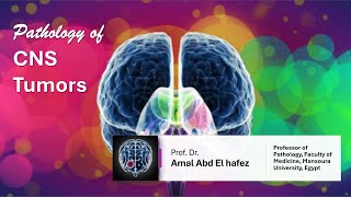 CNS Brain TumorsNeoplasms شرح محاضرة [upl. by Ordnagela755]