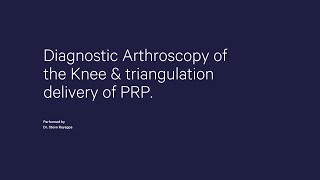 IntraVu Scope Diagnostic Arthroscopy of Knee amp triangulation delivery of PRP Platelet Rich Plasma [upl. by Thevenot366]